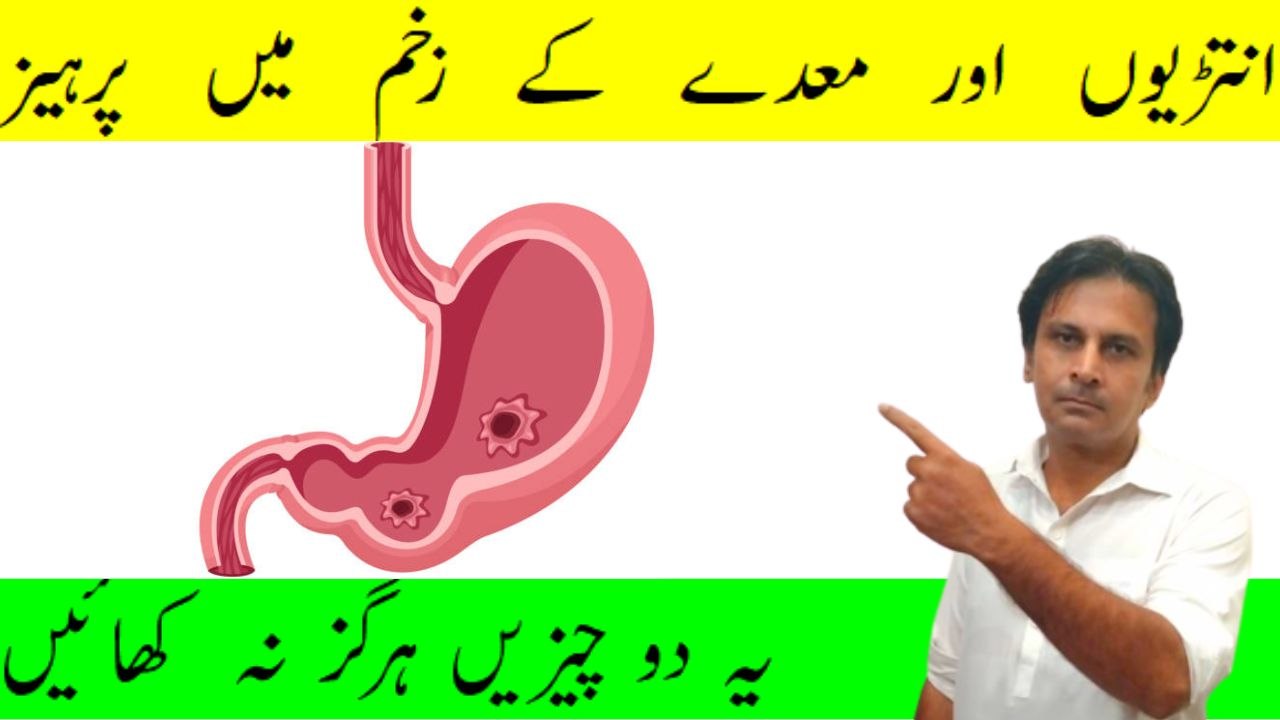 Medy ki sozash ka ilaj | Parheez aur ghiza kon si khani chahiye | Fitness With Arshad