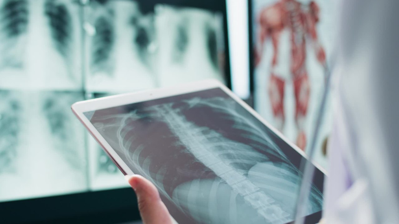These are the most common extra body parts you can have