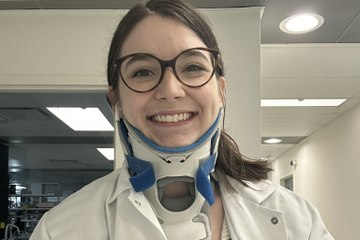 Woman's rare connective tissue disorder was dismissed for anxiety