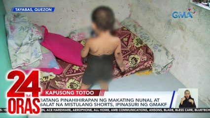 24 Oras Part 2: Ipinasuring malaking nunal at balat ng bata; 772 free wifi sites; itinatayong mega-hemodialysis building ng NKTI, atbp.