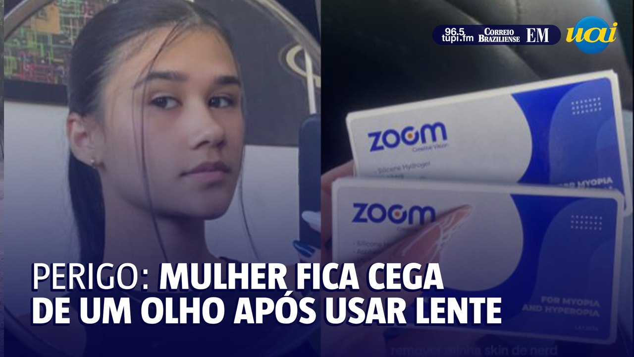 Mulher mostar como ficou cega de um olho usando lentes de contato