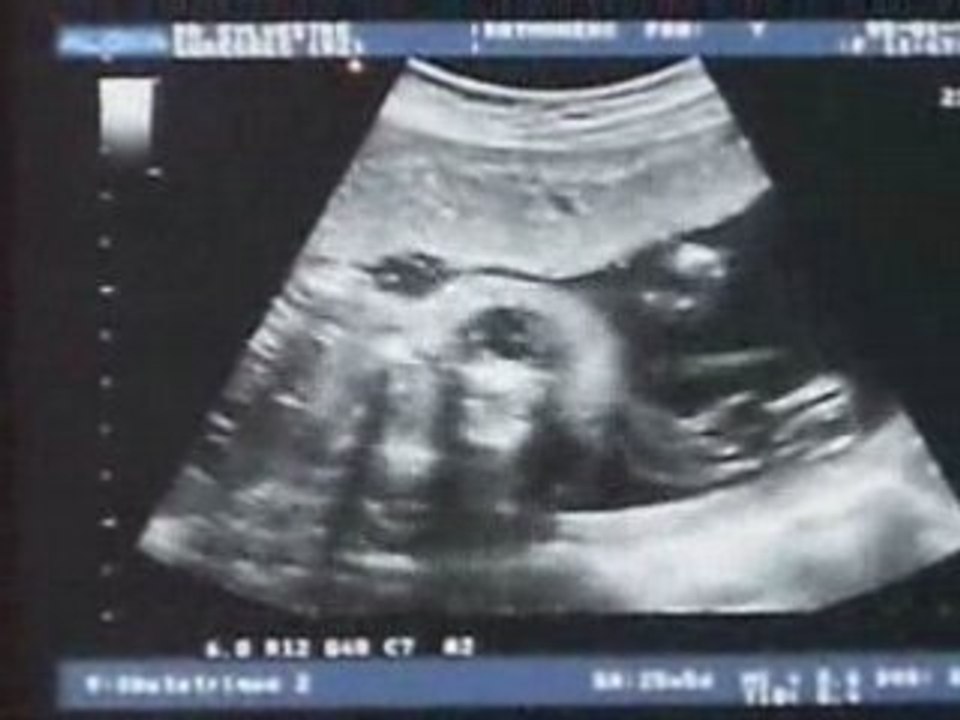 Tete