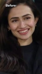 Sana Javed Before And After Picture| #shorts #trending #sanajaved #showbiz
