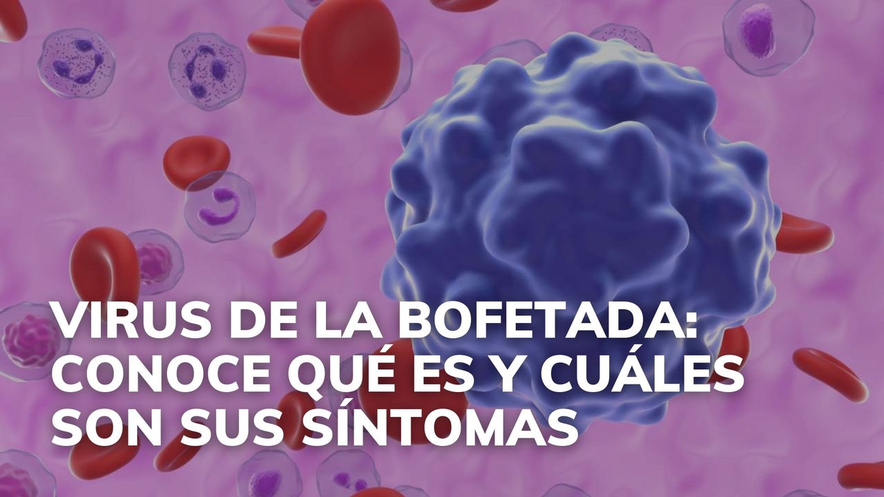 Virus de la bofetada: conoce qué es y cuáles son sus síntomas