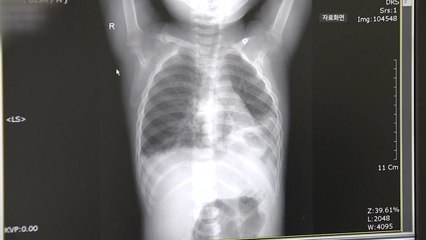 아동병원협회 "아동병원이 소아응급실 역할까지 수행" / YTN