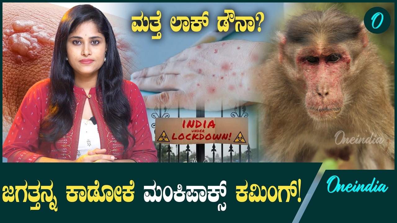 ಮಂಕಿಪಾಕ್ಸ್ ಕಮಿಂಗ್! ಹುಷಾರ್.. ಹೇಗ್ ಬರುತ್ತೆ? ಎಚ್ಚರಿಕೆ ಏನು? ಲಾಕ್ ಡೌನ್ ಸ್ಥಿತಿ ಕ್ರಿಯೇಟ್ ಆಗುತ್ತಾ?