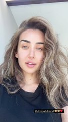 أول ظهور لهنا الزاهد بعد تجميل اسنانها