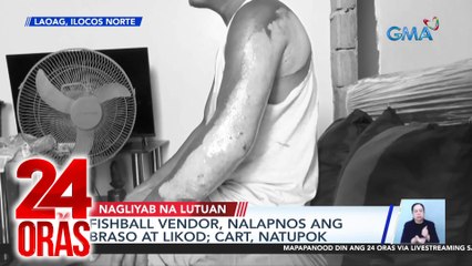 Download Video: Fishball vendor, nalapnos ang braso at likod; cart, natupok | 24 Oras