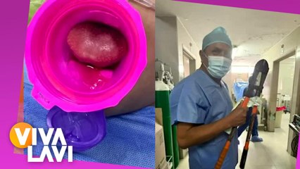 Menor sufre accidente al quedarse su lengua atorada en una tapa