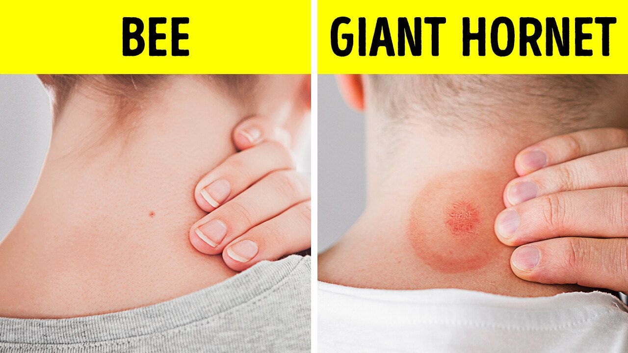 Facts About Bees and Bugs That Will Buzz Your Mind