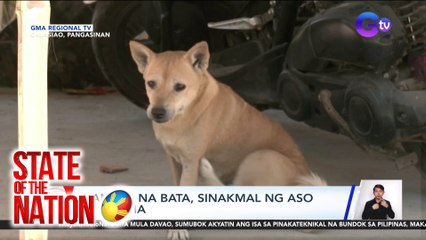 4-anyos na bata, sinakmal ng aso sa mukha | SONA