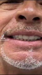 From consultation to a complete smile makeover in one day!