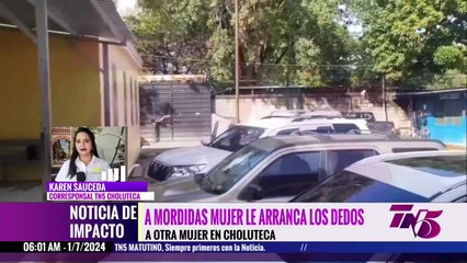 Hondureña le arranca el dedo a otra en Choluteca