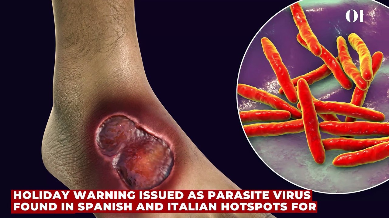 Holiday warning issued as parasite virus found...