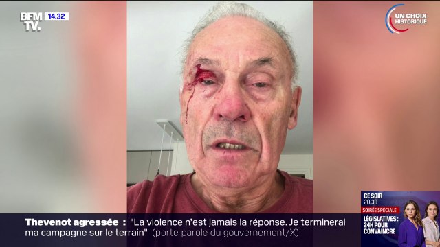Isère: Je prends un coup de poing parce que je colle une affiche, c'est triste dans une démocratie raconte Bernard Dupré, militant pour Ensemble