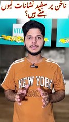 Reason of white spots on nails