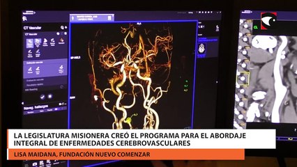 La Legislatura Misionera creó el programa para el abordaje integral de enfermedades cerebrovasculares