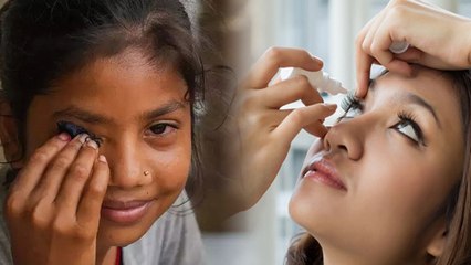 Eye Infection In Rainy Season: Conjunctivtis क्या है, Symptoms & Precaution Tips In Hindi...