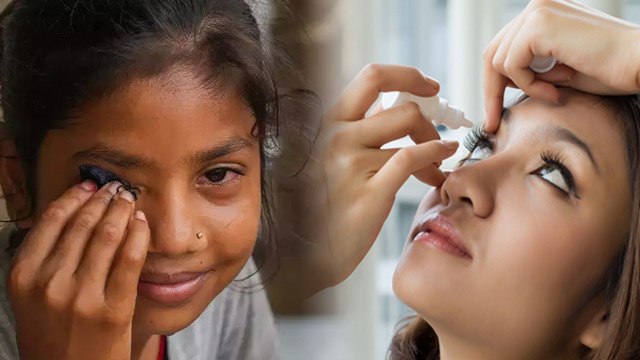 Eye Infection In Rainy Season: Conjunctivtis क्या है, Symptoms & Precaution Tips In Hindi...