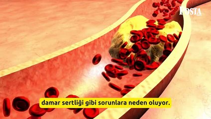 Sivilcelerinizde artış başladıysa aman dikkat! Her 10 kadından biri bu hastalığa sahip, doğurganlığı azaltıyor!