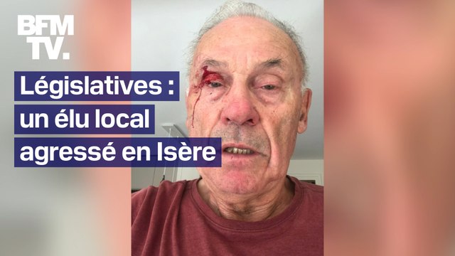 J'ai pris un coup de poing : un élu de 77 ans agressé en Isère alors qu'il collait des affiches pour Olivier Véran