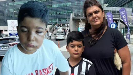 Enfeksiyonlu dişi çekilen 8 yaşındaki çocuk az kalsın gözünden oluyordu