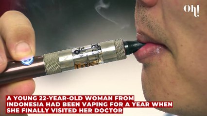 This woman's vaping habit left her covered in ulcers so bad she couldn't eat anymore