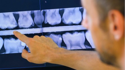 This woman was grinding her teeth so much they fell out 'It happens all the time'