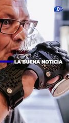 Primer hombre del mundo equipado con dedos impresos en 3D | La buena noticia
