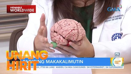 UH Clinic: Madalas ka bang makalimot? | Unang Hirit