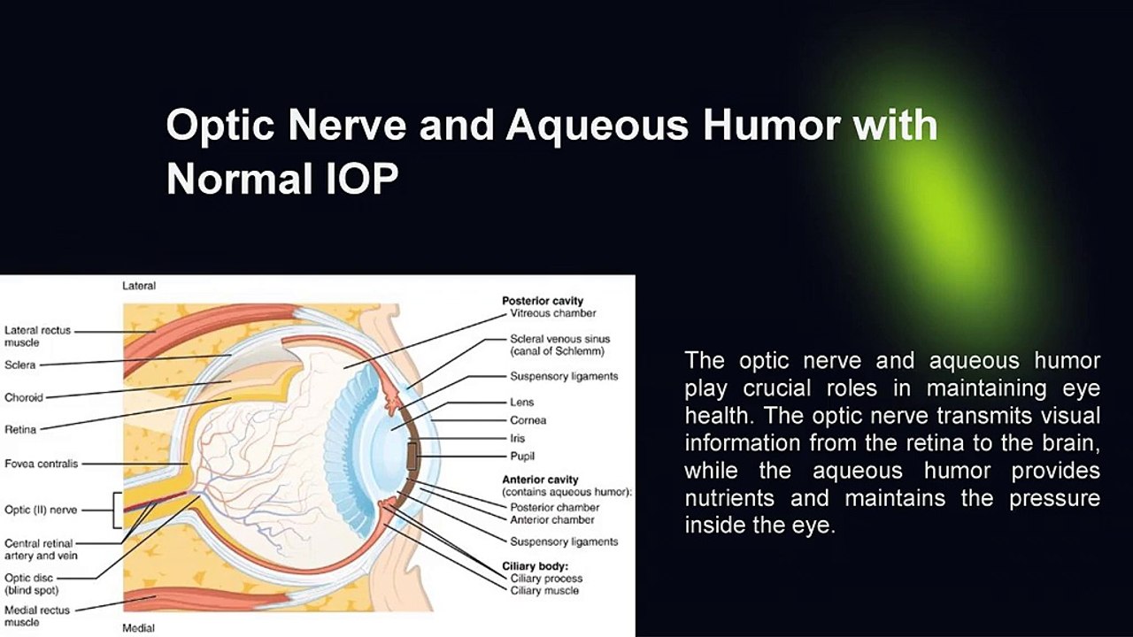 glaucoma
