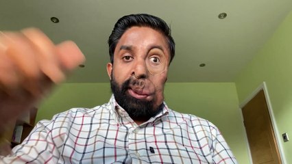 Man with Facial Difference Turns Bullying Experience Into Inspiration for Kids 🚸