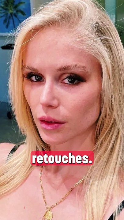 Pourquoi l'actrice de The Boys a-t-elle succombé à la chirurgie esthétique ? 