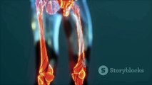 invideo-ai-1080 The Anatomy of the Knee Joint_ Understan 2024-07-10