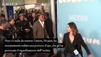 Cos’è successo all’occhio di Matthew McConaughey?