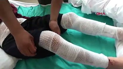 Çobanı düşen yıldırım yaktı, yağan yağmur söndürdü