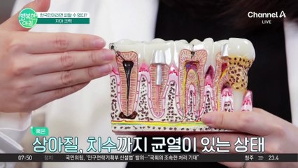 [닥터하우스] 음식물을 씹을 때마다 통증이 있다면? 치아 크랙을 의심하세요! #치아크랙