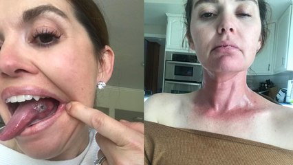 "I can never French kiss my husband again after having half of my tongue removed and replaced with my leg muscle"
