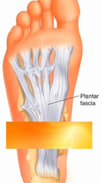 Heel Spur shorts हील स्पर शॉर्ट्स अस्थि स्कंध شورت كعب سبي حفز العظام Heel Pain Relief Foot Solutions Heel Surgery Foot Relief #HeelSpur #PlantarFasciitis #FootPain #HeelPain #BoneSpur #FootCare #Orthotics #FootHealth #PainRelief #HeelSpurTreatment #F