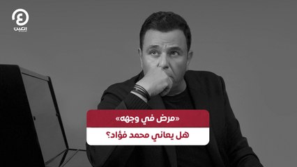 «مرض في وجهه» هل يعاني محمد فؤاد؟