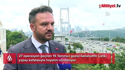 27 operasyon geçirdi! 15 Temmuz gazisi yapay kafatasıyla hayatını sürdürüyor