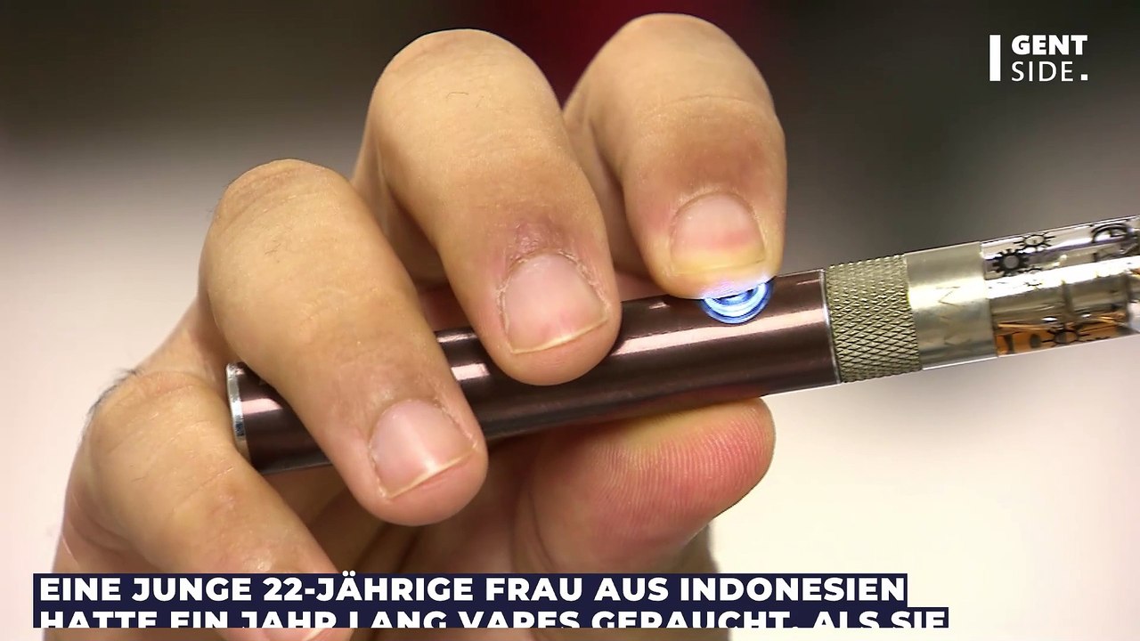 Wegen Vapes: Frau geht mit Schmerzen im Mund zum Arzt und erhält unerwartete Diagnose