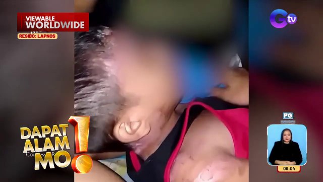 10-anyos na bata, sinadya raw buhusan ng kumukulong tubig | Dapat Alam Mo!