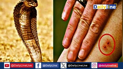 Vikas dubey snake case | Vikas Dubey के सांप कांड का सच आया सामने रिपोर्ट ने खोल दी पोल !|Daily Line
