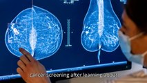 Nearly 40% of women in their 40s would delay mammography screening after learning of its downsides