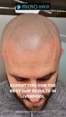 Expert Tips for the Best SMP Results in Liverpool