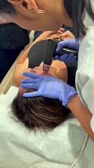 non surgical face lift Glenview