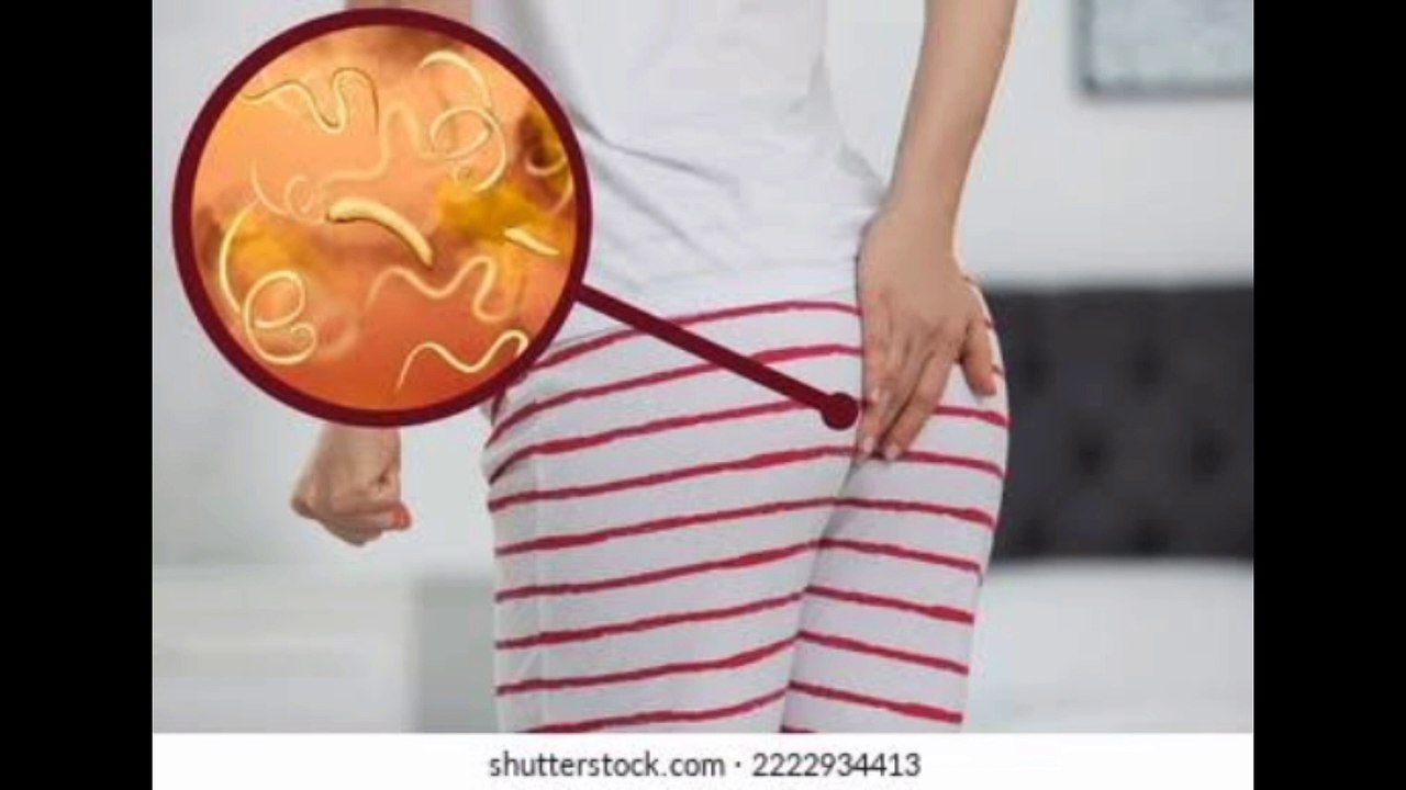 How to get rid of pinworms
