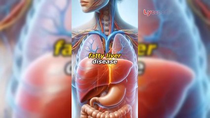 Fatty liver causes and treatment