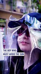 The boy who must avoid the sun